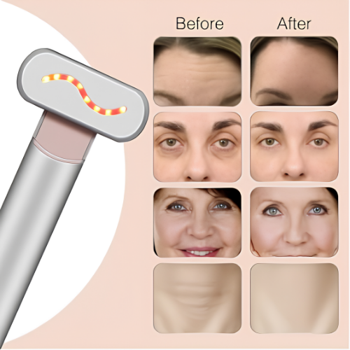 Eye Beauty Device
