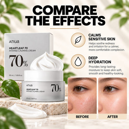 Anua - Moisturizer Cream